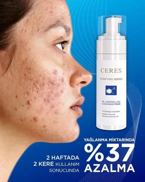 Ceres Oil Controlling Cleansing Foam 180 ml