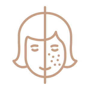 Leke/Renk Tonu Eşitsizliği